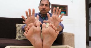 حطم الأرقام القياسية ودخل موسوعة جينيس بـ28 أصبع
