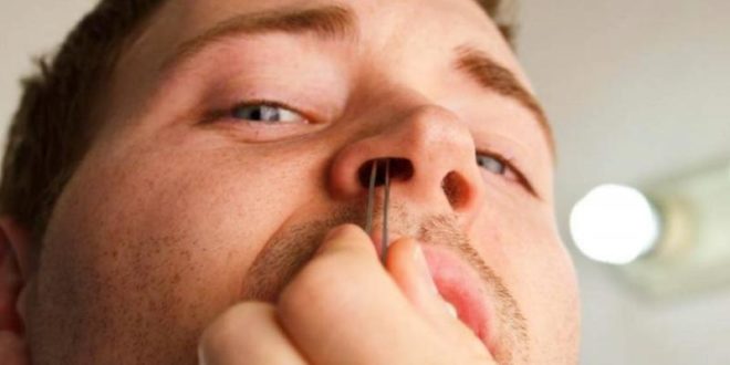 رجل يكتشف سناً نما في أنفه 20عاماً