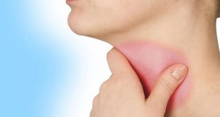 أعراض التهاب الحلق وطرق منزلية لعلاجه