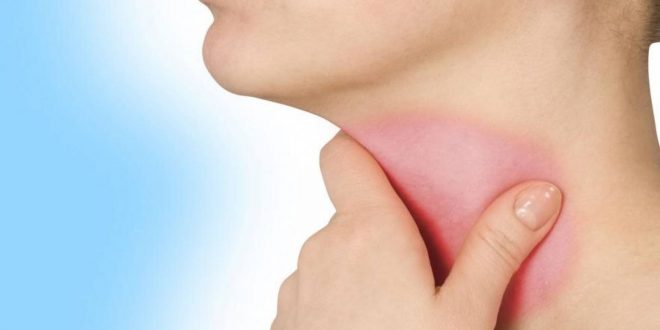 أعراض التهاب الحلق وطرق منزلية لعلاجه