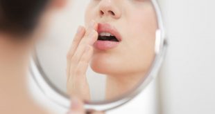 تعرف على طرق علاج حرق الشفاه