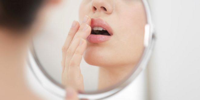 تعرف على طرق علاج حرق الشفاه
