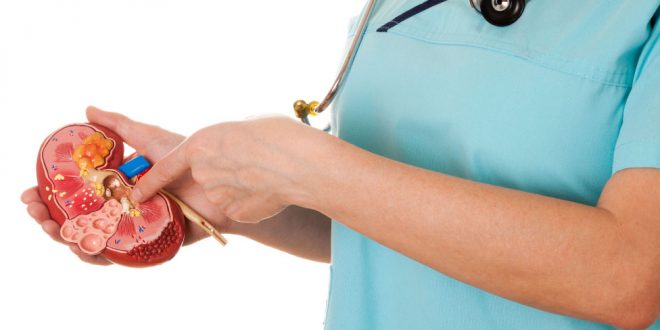 تعرف على طرق علاج حصوات الكلى