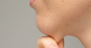 طرق طبيعية للتخلص من دهون الرقبة والذقن