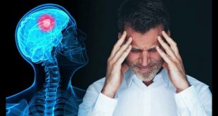 كل ما تريد معرفته عن السكتة الدماغية.. الأعراض وطرق العلاج