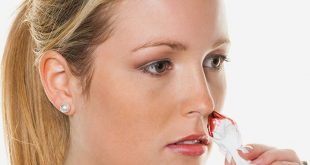 تعرف على أسباب الاصابه بنزيف الأنف