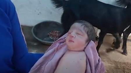 ولادة طفلة في الهند من دون أطراف