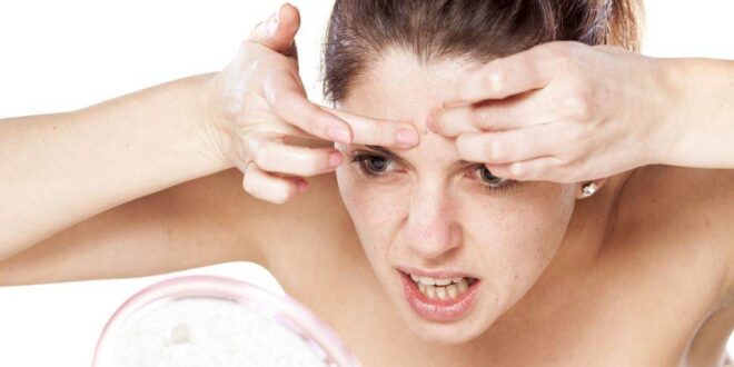 5 أسباب لظهور حب الشباب والبثور بشكل مفاجئ