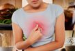 تعرف على الطرق المختلفه لعلاج حرقة المعدة