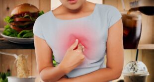 تعرف على الطرق المختلفه لعلاج حرقة المعدة