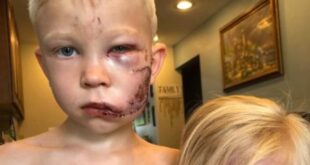 قصة طفل شجاع ينضم للأبطال الخارقين بعد إنقاذ شقيقته من كلب مفترس