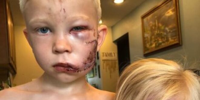 قصة طفل شجاع ينضم للأبطال الخارقين بعد إنقاذ شقيقته من كلب مفترس