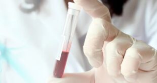 علامات تدل على الإصابة بجرثومة المعدة