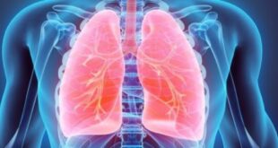 ما هى خيارات العلاج لسرطان الرئة