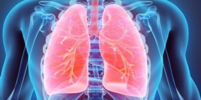 ما هى خيارات العلاج لسرطان الرئة