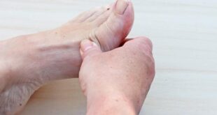 أعراض القدم السكرى عديدة وأبرزها تغير لون الجلد