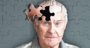 أمل جديد لعلاج الزهايمر .. اكتشاف جين يحمي من المرض