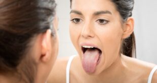 علاج جفاف الفم بطرق بسيطة أبرزها تجنب الكافيين