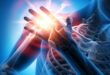 كل ما تريد معرفته عن الكتف المتجمدة وأعراض الإصابة