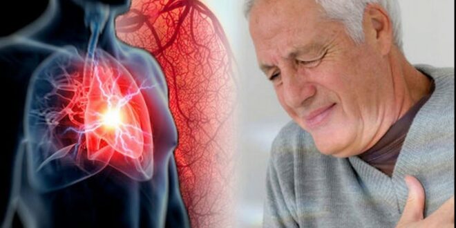 ما أعراض الإصابة بالشريان التاجى وطرق الوقاية؟