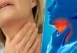 ما أعراض وأسباب وعلاج التهاب الحلق؟