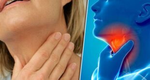 ما أعراض وأسباب وعلاج التهاب الحلق؟