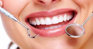 أسباب ترسبات الأسنان وعنايتها بالعلاجات المنزلية وزيارة الطبيب مهمة
