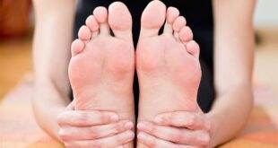 احتباس الماء.. الأسباب والأعراض وطرق العلاج