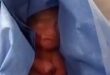 طفل مكسيكي يظل فى المشرحة 6 ساعات ظنا بأنه توفى