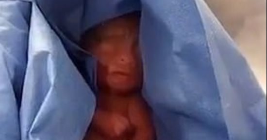 طفل مكسيكي يظل فى المشرحة 6 ساعات ظنا بأنه توفى