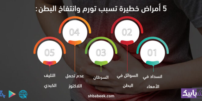 5 أمراض خطيرة تسبب تورم وانتفاخ البطن