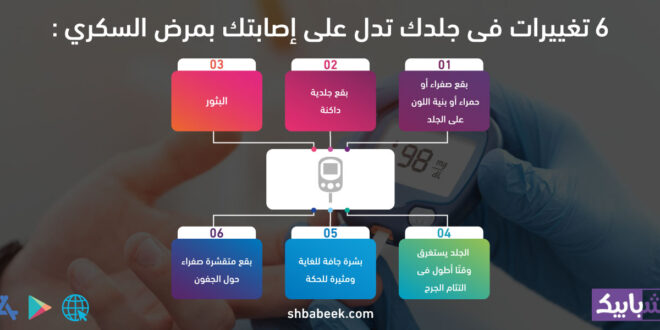 6 تغييرات فى جلدك تدل على إصابتك بمرض السكرى