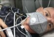 بريطانى يصاب بالعمى والشلل بعد لدغة قاتلة من كوبرا فى الهند