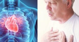 تعرف على أعراض مرض الشريان التاجى للقلب وكيفية العلاج