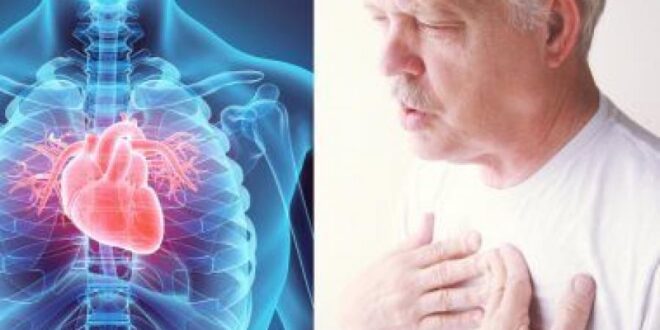 تعرف على أعراض مرض الشريان التاجى للقلب وكيفية العلاج