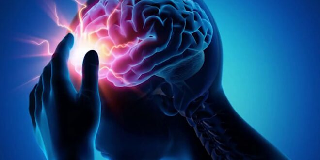 أستاذ أعصاب: أول ساعة تمر على مريض جلطة المخ يفقد 120 مليون خلية عصبية