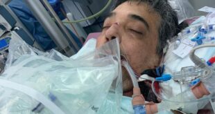 أطول فترة تعافى.. مريض بريطاني يعود للمنزل بعد 222 يومًا في المستشفى