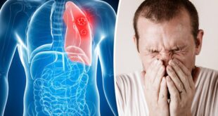 تلوث الهواء فى الشتاء يسبب سرطان الرئة
