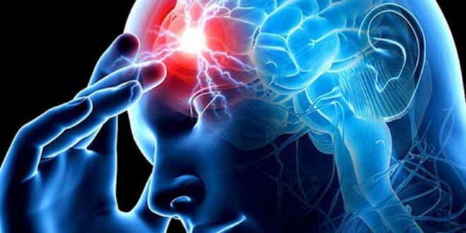 مرضى فيروس كورونا من الحالات المعتدلة قد يتعرضون للسكتة الدماغية