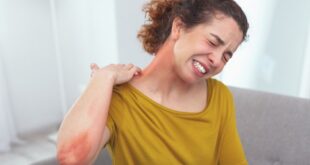 الحكة الحادة لدى مرضى الإكزيما سببها حساسية من البيئة المحيطة