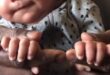 تفاعل كبير مع فيديو 'تيك توك' لطفلة بريطانية مولودة بـ12 إصبعا فى يديها