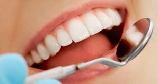 5 مشاكل شائعة للأسنان وكيفية العلاج