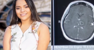 فتاة أمريكية تصاب بشلل فى ذراعيها وسكتة دماغية بسبب فيروس كورونا