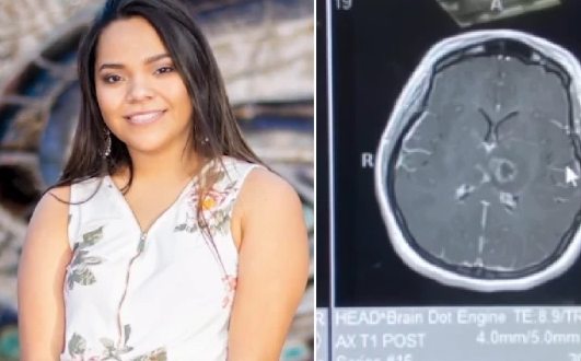 فتاة أمريكية تصاب بشلل فى ذراعيها وسكتة دماغية بسبب فيروس كورونا