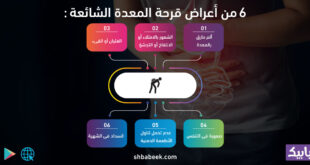6 من أعراض قرحة المعدة الشائعة