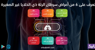 تعرف على 6 من أعراض سرطان الرئة ذي الخلايا غير الصغيرة