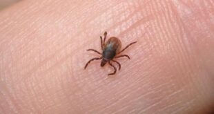 أمراض خطيرة تسببها حشرة القراد.. التهاب الدماغ وفقدان الذاكرة الأبرز