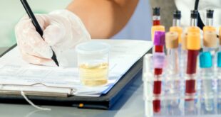 حالات تستدعى إجراء تحليل الميوجلوبين.. منها النوبة القلبية