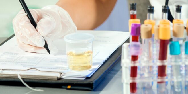 حالات تستدعى إجراء تحليل الميوجلوبين.. منها النوبة القلبية
