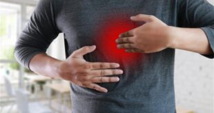 علاج ارتجاع المرئ بدون أدوية.. 5 أعشاب طبيعة تخلصك منه